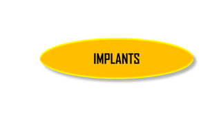 IMPLANTS
 