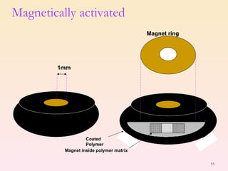 Magnetically activated  1mm Magnet ring Coated Polymer Magnet inside polymer matrix 