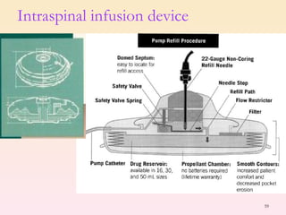 Intraspinal infusion device 