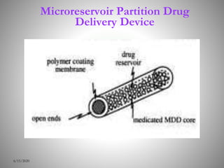 Microreservoir Partition Drug
Delivery Device
6/15/2020
 