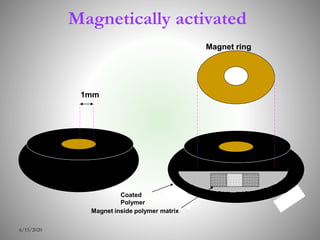 Magnetically activated
6/15/2020
1mm
Magnet ring
Coated
Polymer
Magnet inside polymer matrix
 