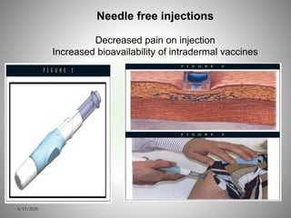 6/15/2020
Needle free injections
Decreased pain on injection
Increased bioavailability of intradermal vaccines
 