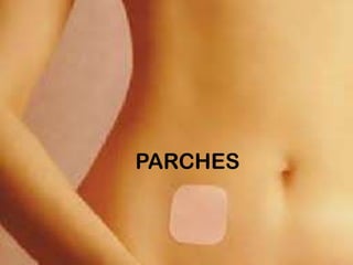 PARCHES
 