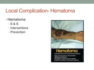 Local Complication- Hematoma
• Hematoma
• S & S
• Interventions
• Prevention
 