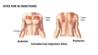 Ian Injection Map PARENTERAL INJECTIONS.pptx