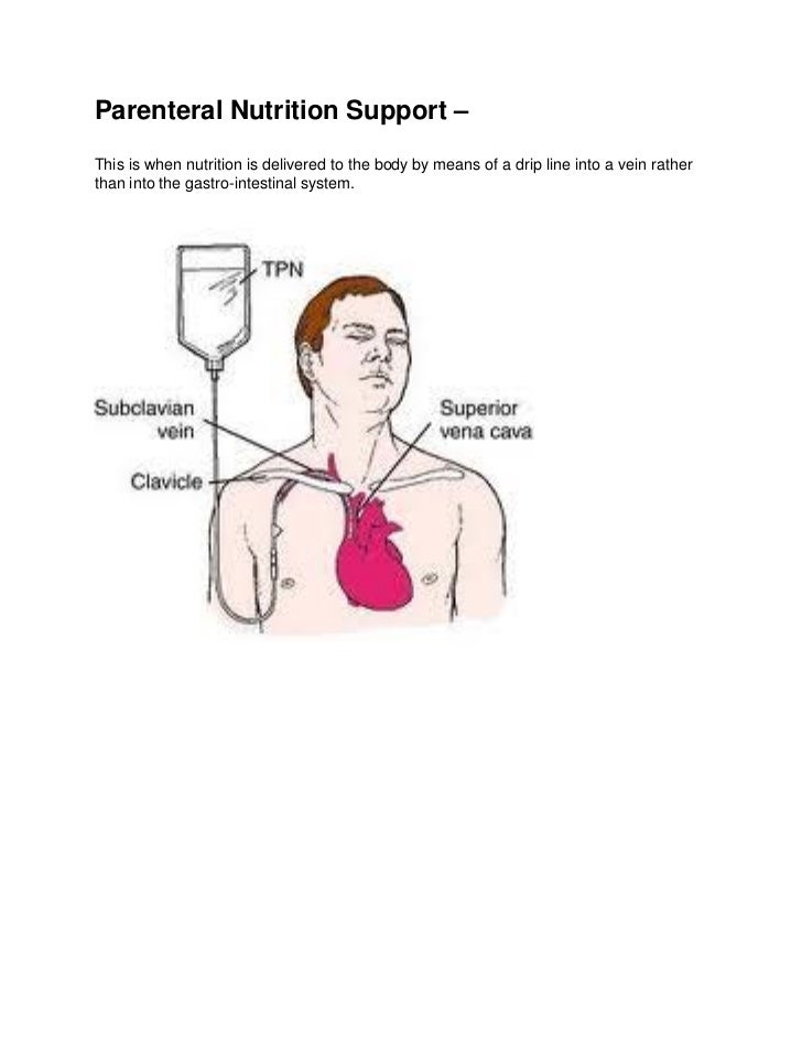 Parenteral nutrition support picture
