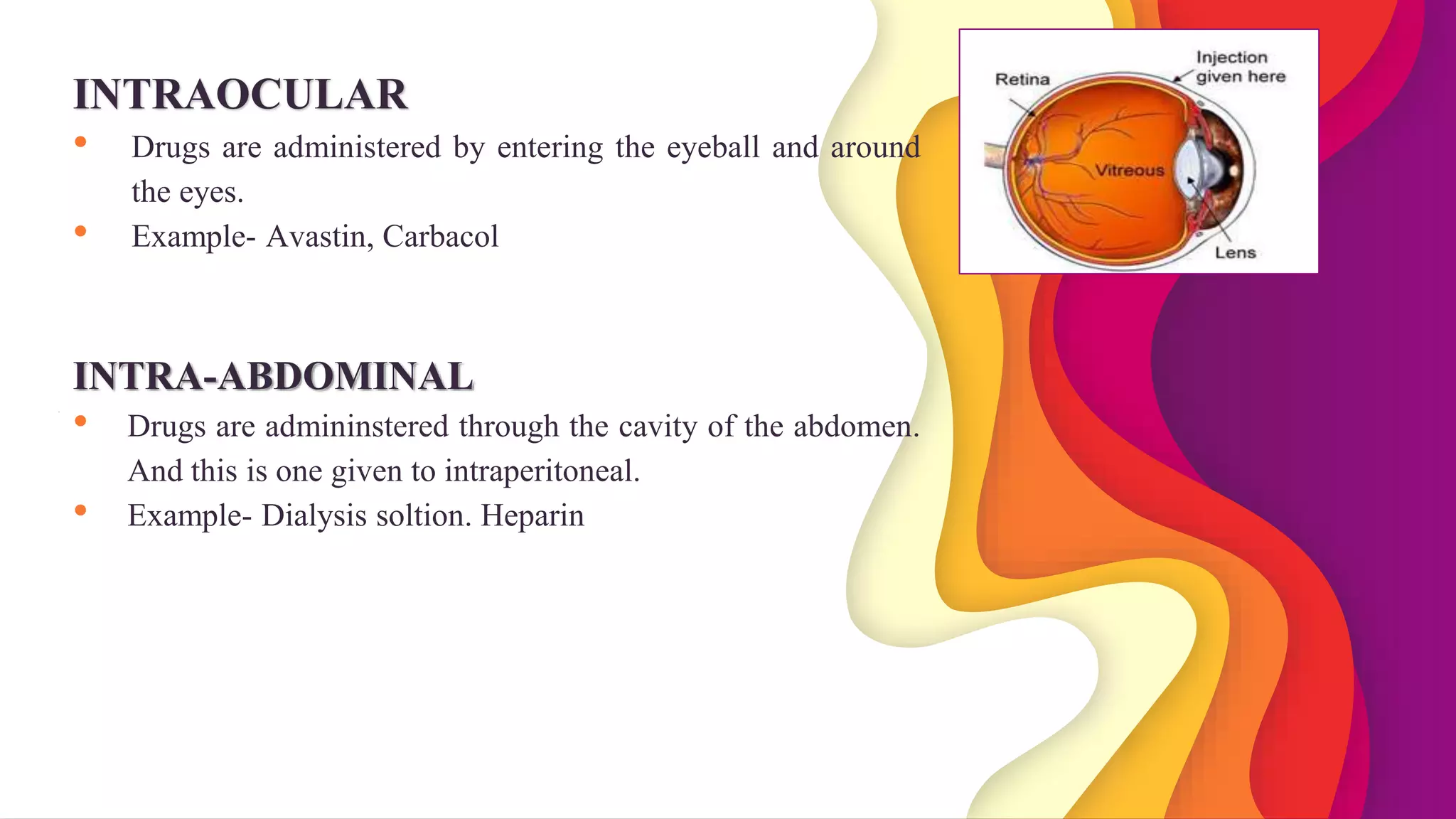 Types of Parenteral Formulation | PPTX