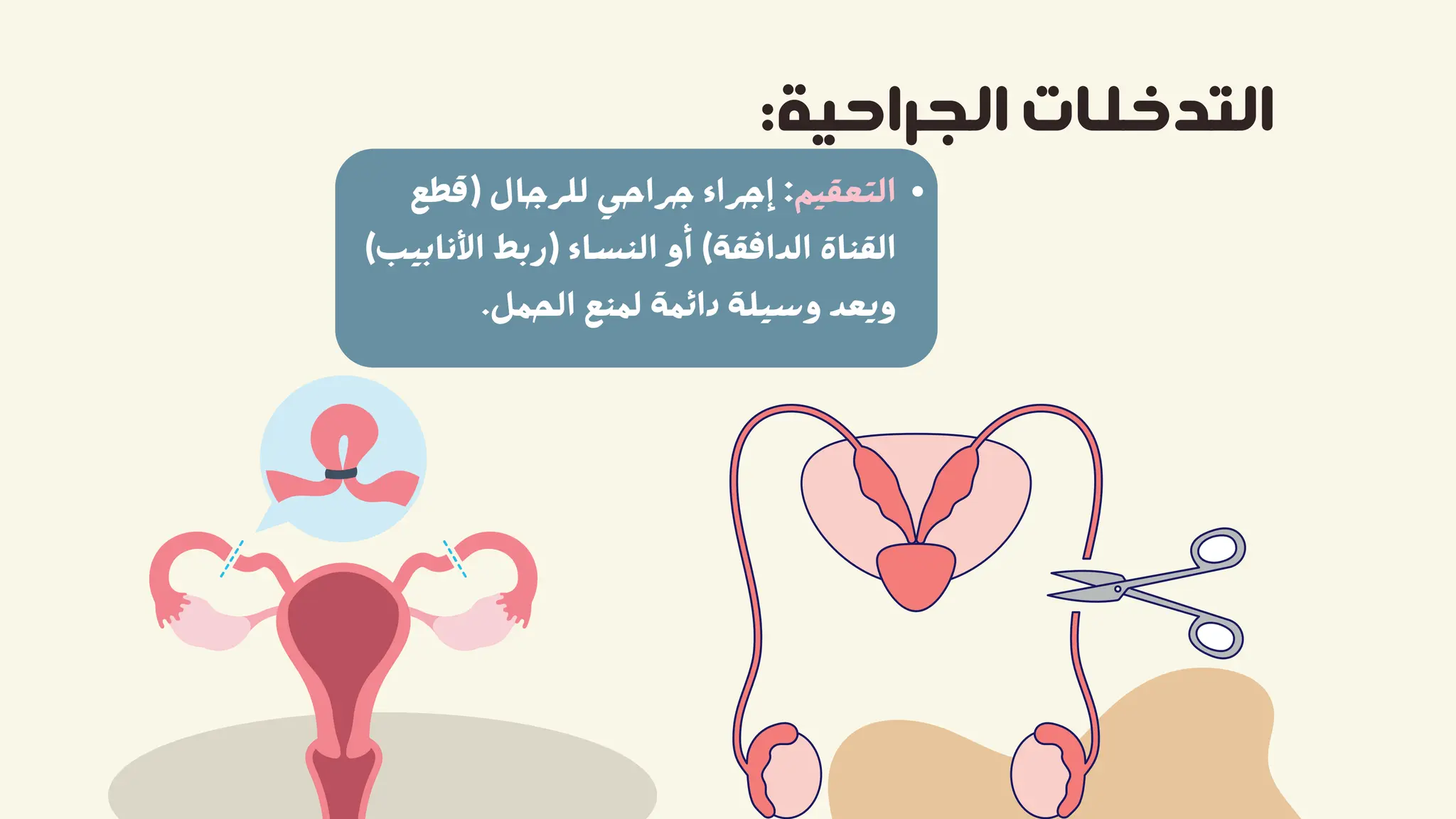 ‫)ﻗﻄﻊ‬ ‫ﻟﻠﺮﺟﺎل‬ ‫ﺟﺮاﺣﻲ‬ ‫إﺟﺮاء‬ :‫اﻟﺘﻌﻘﻴﻢ‬
(‫اﻷﻧﺎﺑﻴﺐ‬ ‫)رﺑﻂ‬ ‫اﻟﻨﺴﺎء‬ ‫أو‬ (‫اﻟﺪاﻓﻘﺔ‬ ‫اﻟﻘﻨﺎة‬
.‫اﻟﺤﻤﻞ‬ ‫ﻟﻤﻨﻊ‬ ‫داﺋﻤﺔ‬ ‫وﺳﻴﻠﺔ‬ ‫وﻳﻌﺪ‬
:‫اﻟﺠﺮاﺣﻴﺔ‬ ‫اﻟﺘﺪﺧﻠﺎت‬
 