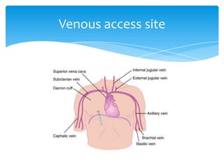 Venous access site