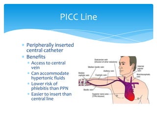 Peripherally inserted central catheterBenefitsAccess to central veinCan accommodate hypertonic fluidsLower risk of phlebitis than PPNEasier to insert than central linePICC Line