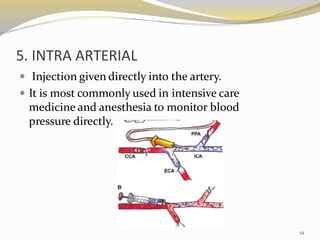 5. INTRA ARTERIAL
 Injection given directly into the artery.
 It is most commonly used in intensive care
medicine and anesthesia to monitor blood
pressure directly.
12
 