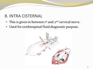 8. INTRA CISTERNAL
 This is given in between 1st and 2nd cervical nerve.
 Used for cerebrospinal fluid diagnostic purpose.
15
 