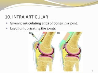 10. INTRA ARTICULAR
 Given to articulating ends of bones in a joint.
 Used for lubricating the joints.
17
 