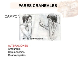 PARES CRANEALES
CAMPO VISUAL
Test de confrontación
ALTERACIONES
Amaurosis
Hemianopsias
Cuadranopsias
 