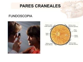 PARES CRANEALES
FUNDOSCOPIA
 