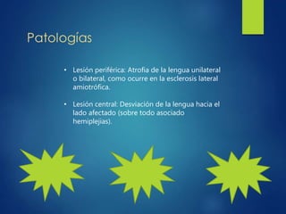 • Lesión periférica: Atrofia de la lengua unilateral
o bilateral, como ocurre en la esclerosis lateral
amiotrófica.
• Lesión central: Desviación de la lengua hacia el
lado afectado (sobre todo asociado
hemiplejias).
 