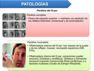 PATOLOGÍAS
Parálisis del III par
Parálisis completa
• Ptosis del párpado superior -> midriasis con abolición de
los reflejos fotomotor, consensual y de acomodación;
Parálisis incompleta
• Oftalmoplejía externa del III par: hay respeto de la pupila
y de los reflejos. Causas: neuropatía isquémica (DM,
HTA)
• Oftalmoplejía interna del III par: compromiso pupilar
exclusivo (midriasis y arreflexia). Obedece a herniación
temporal incipiente (compromete fibras periféricas) o a
lesiones nucleares (núcleo de Edinger-Westphal).
 