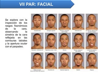 Se explora con la
inspección de los
rasgos fisonómicos
de la cara,
observando la
simetría de la cara
reflejada en las
comisuras labiales
y la apertura ocular
con el parpadeo.
VII PAR: FACIAL
 