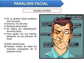  Es la parálisis facial periférica
más frecuente
 Entre los 18 y 50 años
 Etiología desconocida
 Se origina por edematización
del nervio facial
 Inicio agudo, con una máxima
afectación en las primeras 48
horas
 Dolor retroauricular
 Parálisis motora de todos los
músculos encargados de la
expresión facial
PARÁLISIS FACIAL
Idiopática (de Bell)
 