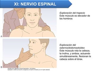XI: NERVIO ESPINAL
Exploración del
esternocleidomastoideo
Este músculo rota la cabeza,
la inclina, y ambos, actuando
simultáneamente, flexionan la
cabeza sobre el tórax.
Exploración del trapecio
Este músculo es elevador de
los hombros
 