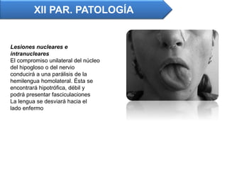 XII PAR. PATOLOGÍA
Lesiones nucleares e
intranucleares
El compromiso unilateral del núcleo
del hipogloso o del nervio
conducirá a una parálisis de la
hemilengua homolateral. Ésta se
encontrará hipotrófica, débil y
podrá presentar fasciculaciones
La lengua se desviará hacia el
lado enfermo
 