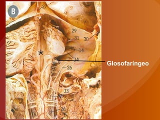 Glosofaríngeo
 