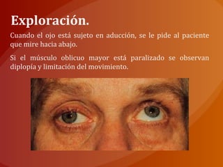 Exploración.
Cuando el ojo está sujeto en aducción, se le pide al paciente
que mire hacia abajo.
Si el músculo oblicuo mayor está paralizado se observan
diplopía y limitación del movimiento.
 