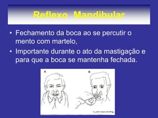 Reflexo Mandibular 
•Fechamento da boca ao se percutir o mento com martelo, 
•Importante durante o ato da mastigação e para que a boca se mantenha fechada.  