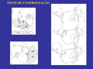 TESTE DE CONFRONTAÇÃO  