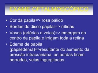 EXAME OFTALMOSCÓPICO 
•Cor da papila=> rosa pálido 
•Bordas do disco papilar=> nítidas 
•Vasos (artérias e veias)=> emergem do centro da papila e irrigam toda a retina 
•Edema de papila (papiledema)=>resultante do aumento da pressão intracraniana, as bordas ficam borradas, veias ingurgitadas.  