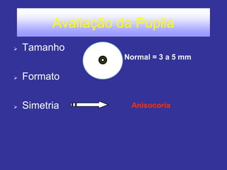 Avaliação da Pupila 
Tamanho 
Formato 
Simetria 
Normal = 3 a 5 mm 
Anisocoria  