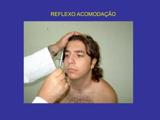 REFLEXO ACOMODAÇÃO  