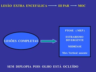 LESÃO EXTRA ENCEFÁLICA III PAR MOC 
LESÕES COMPLETAS 
PTOSE ( MEP ) 
ESTRABISMO 
DIVERGENTE 
MIDRÍASE 
Mov. Vertical ausente 
SEM DIPLOPIA POIS OLHO ESTÁ OCLUÍDO  