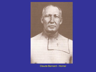 Claude Bernard - Horner  