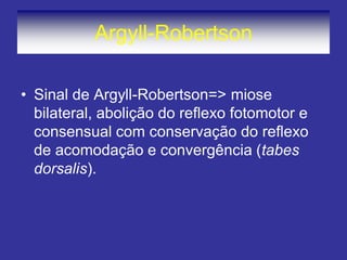 Argyll-Robertson 
•Sinal de Argyll-Robertson=> miose bilateral, abolição do reflexo fotomotor e consensual com conservação do reflexo de acomodação e convergência (tabes dorsalis).  