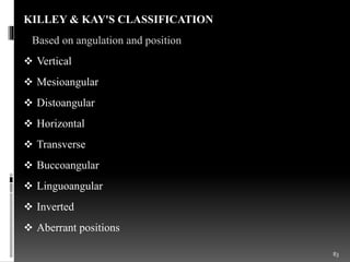Kay Classification SURGICAL EXTRACTION OF MANDIBULAR THIRD MOLAR | PPTX