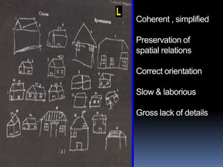ApraxiaLimb apraxia–Limb kinetic / melokineticIdeomotorIdeationalDisassociation ConductionConceptual Constructional & dressing –often associated with neglect & visual perceptual disorders
