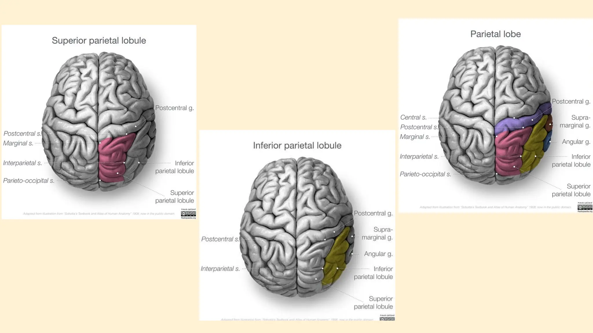 Parietal Lobule Radiopaedia