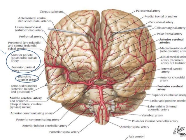 Parietal lobe tumor