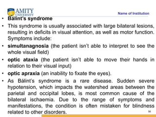 Name of Institution
• Bálint’s syndrome
• This syndrome is usually associated with large bilateral lesions,
resulting in d...
