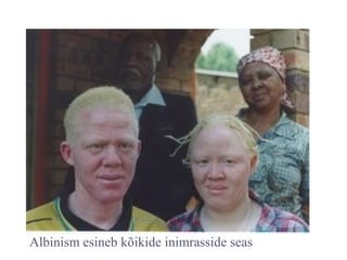 Albinism esineb kõikide inimrasside seas
 