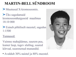 MARTIN-BELL SÜNDROOM
Muutused X-kromosoomis.
Üks sagedamaid
kromosoomhaiguseid maailmas
18:10 000
Esineb põhiliselt meestel, sagedus
1:1500
Tunnused:
Vaimne mahajäämus, suurem pea,
kumer laup, tugev alalõug, suured
kõrvad, suurenenud munandid.
• Avaldub 30% naistel ja 80% meestel.
 