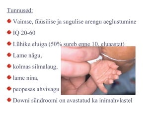 Tunnused:
Vaimse, füüsilise ja sugulise arengu aeglustumine
IQ 20-60
Lühike eluiga (50% sureb enne 10. eluaastat)
Lame nägu,
kolmas silmalaug,
lame nina,
peopesas ahvivagu
Downi sündroomi on avastatud ka inimahvlastel
 