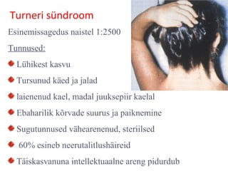 Turneri sündroom
Esinemissagedus naistel 1:2500
Tunnused:
Lühikest kasvu
Tursunud käed ja jalad
laienenud kael, madal juuksepiir kaelal
Ebaharilik kõrvade suurus ja paiknemine
Sugutunnused vähearenenud, steriilsed
60% esineb neerutalitlushäireid
Täiskasvanuna intellektuaalne areng pidurdub
 