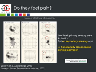 Do they feel pain?
Low level primary sensory area
Activation
But no secondary sensory area
 Functionally disconnected
cortical activation
Noxious electrical stimulation
Laureys et al, Neuroimage, 2002
Laureys, Nature Reviews Neuroscience, 2005
 