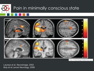 Pain in minimally conscious state
Laureys et al, Neuroimage, 2002
Boly et al Lancet Neurology, 2008
 