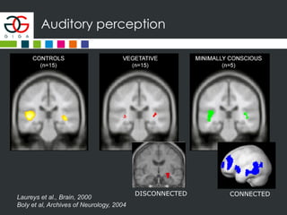 Auditory perception
Laureys et al., Brain, 2000
Boly et al, Archives of Neurology, 2004
DISCONNECTED CONNECTED
 