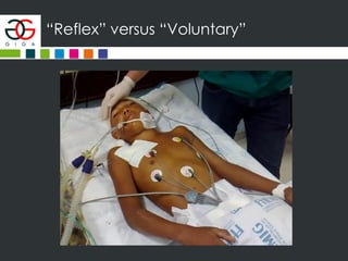 “Reflex” versus “Voluntary”
 