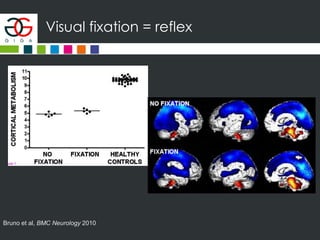 Visual fixation = reflex
Bruno et al, BMC Neurology 2010
 