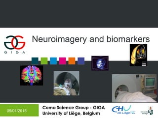Coma Science Group - GIGA
University of Liège, Belgium
Neuroimagery and biomarkers
05/01/2015
 